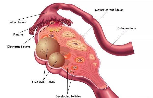 卵巢生理结构图