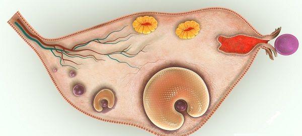 多囊卵巢的科学释疑