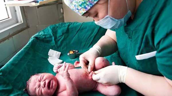 剖腹产出生后的胎儿