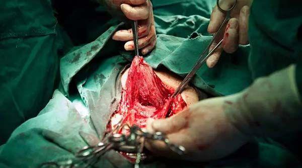 剖腹产手术产妇分娩流程