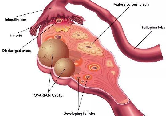 如何改善子宫内膜
