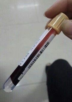 抽血验HCG