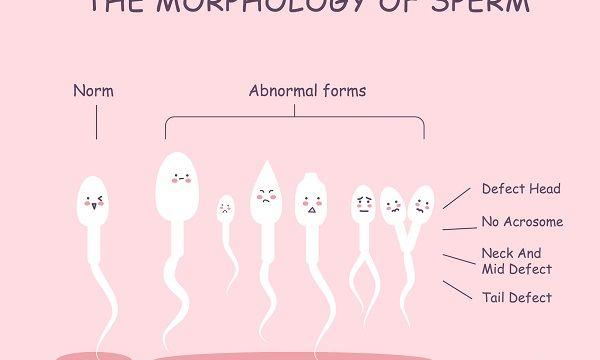精子异常对怀孕有影响
