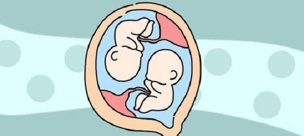 双胎只停育一个较为常见