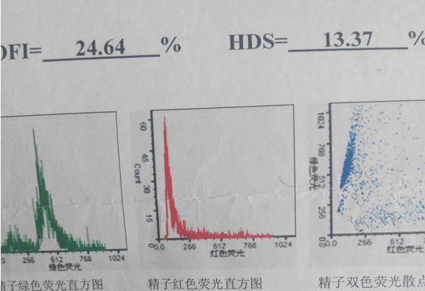 精子碎片率怎么检查