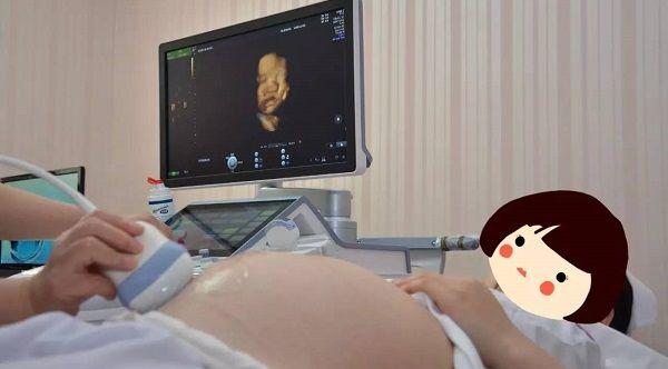 孕妇正在做四维检查