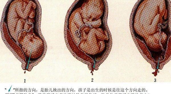 胎儿胎位图