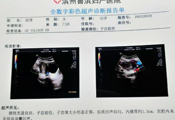 移植35天孕囊大小标准