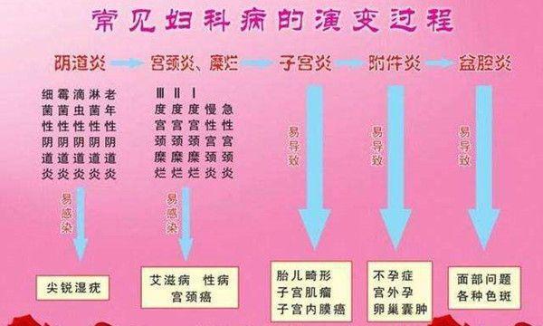 常见妇科病的演变过程