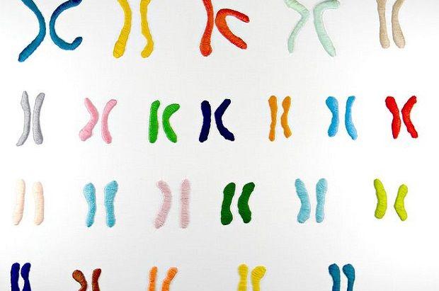 染色体异常