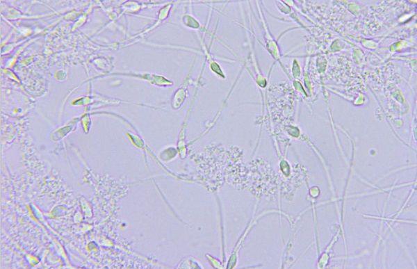 精子在显微镜下的形态