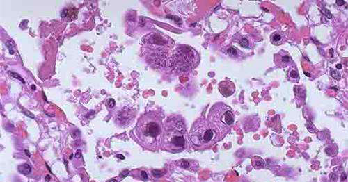 巨细胞病毒两种生物学特征