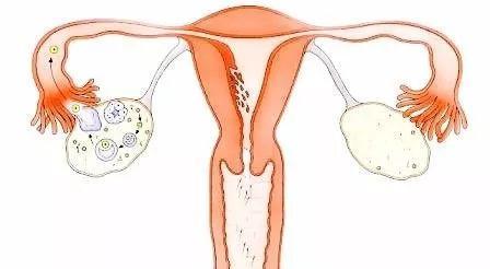 促排对卵巢的影响