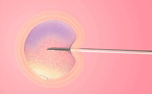 囊胚移植