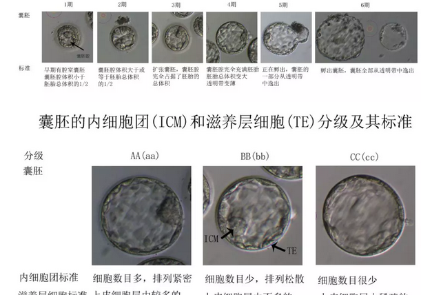 囊胚评分