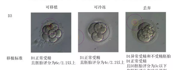 取卵后第3天丢弃胚胎的标准