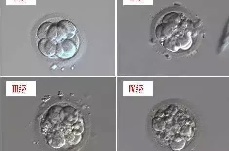 胚胎等级怎么分