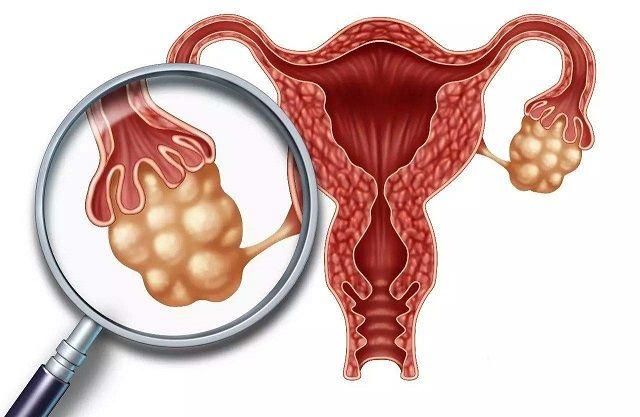子宫内膜过厚或过薄都不利于试管胚胎移植