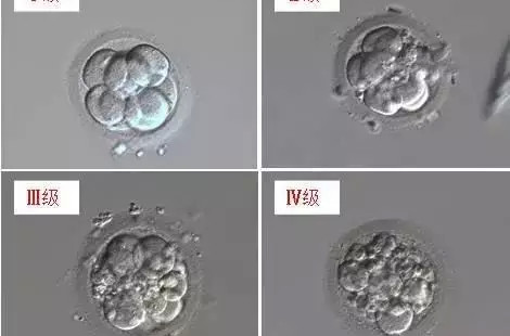 D3胚胎等级怎么分