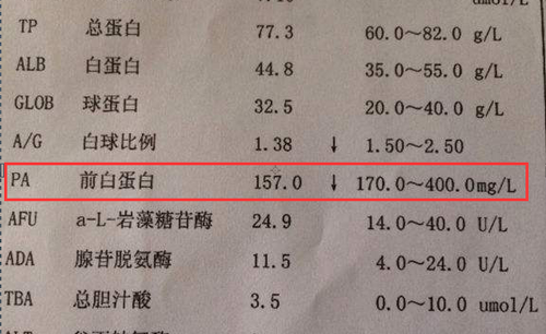 血清前白蛋白检查报告单