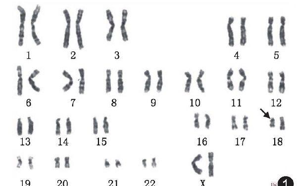 人类染色体模型