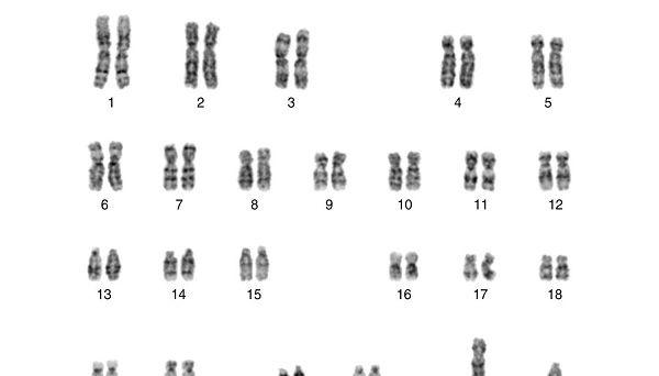 正常染色体核型