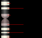 19号染色体图谱