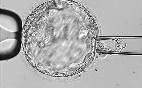 什么条件可以移植鲜胚