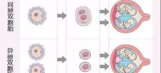 同卵双胞胎与异卵双胞胎