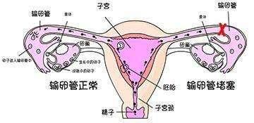 女性的输卵管