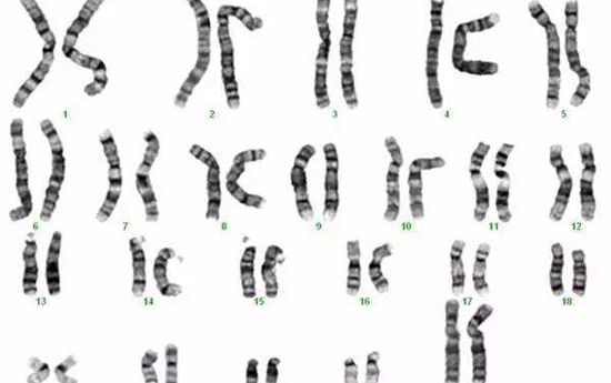 染色体核型检查