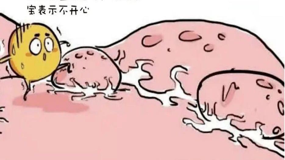 子宫肌瘤图片.jpg