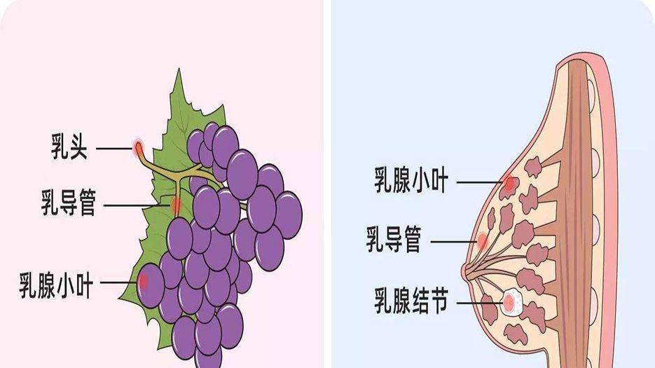 乳腺结节...jpg