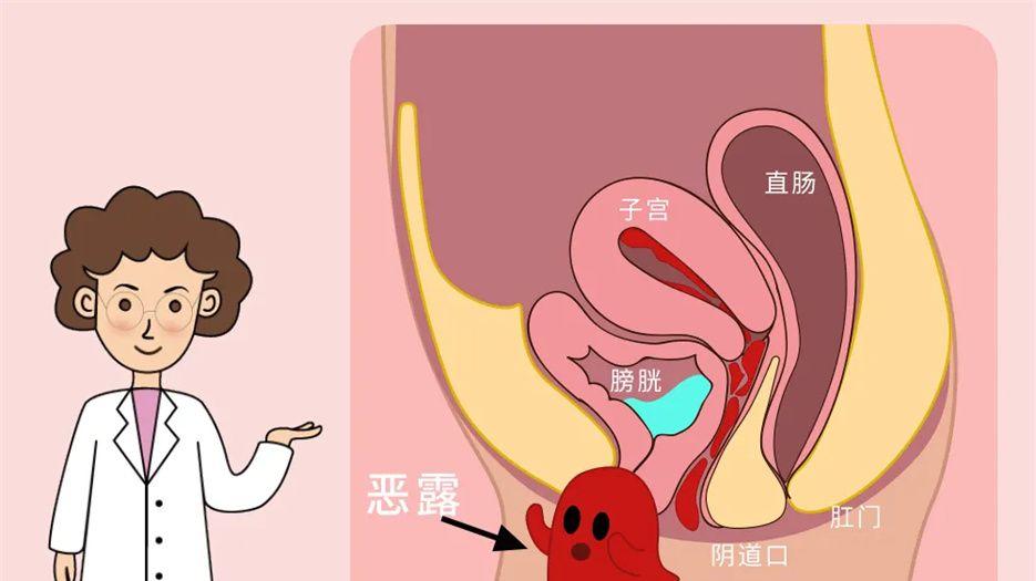 恶露快干净的前兆,身体出现这些颜色时恭喜子宫已经干净了