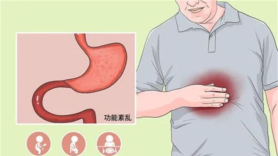 功能性疾病.jpg