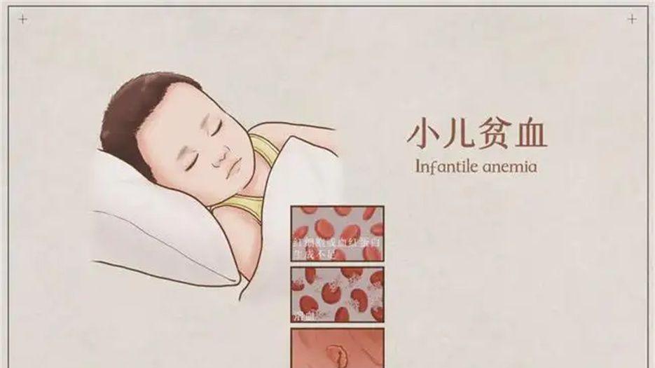 儿童贫血.jpg