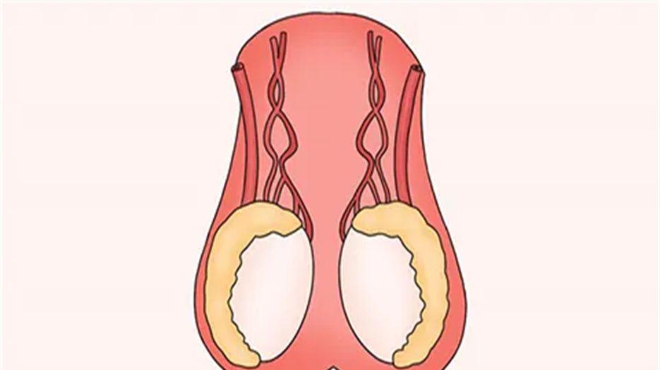 睾丸.jpg