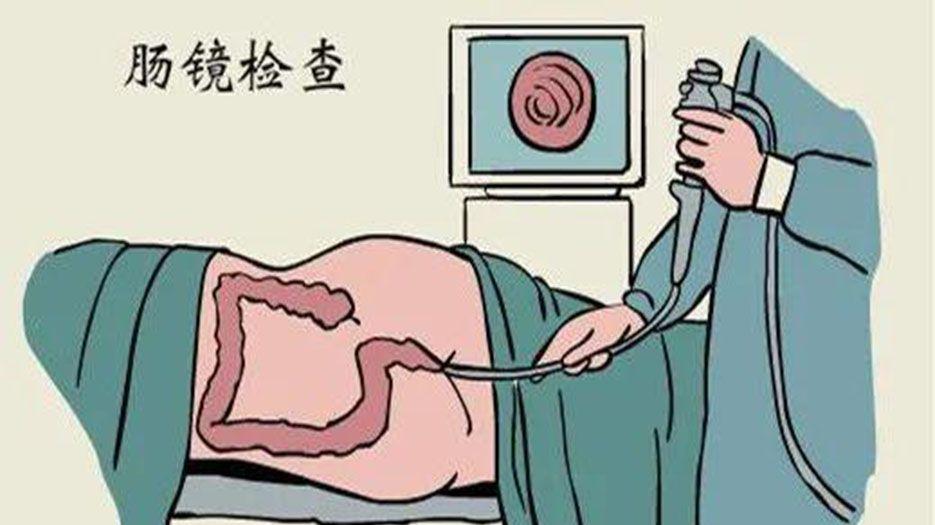 肠镜检查.jpg