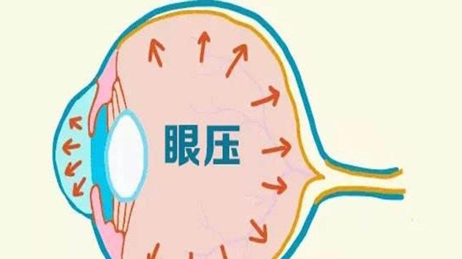 眼压.webp.jpg