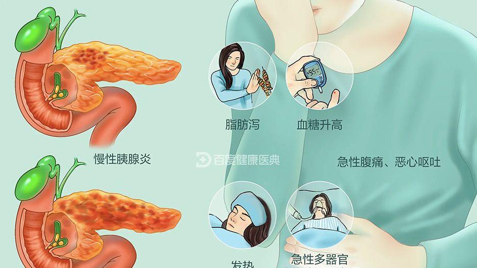 胰腺炎.webp.jpg