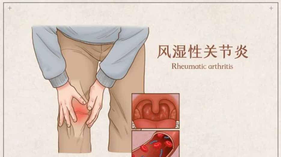 风湿.jpg