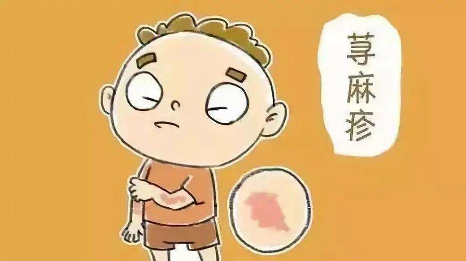 荨麻疹.webp.jpg