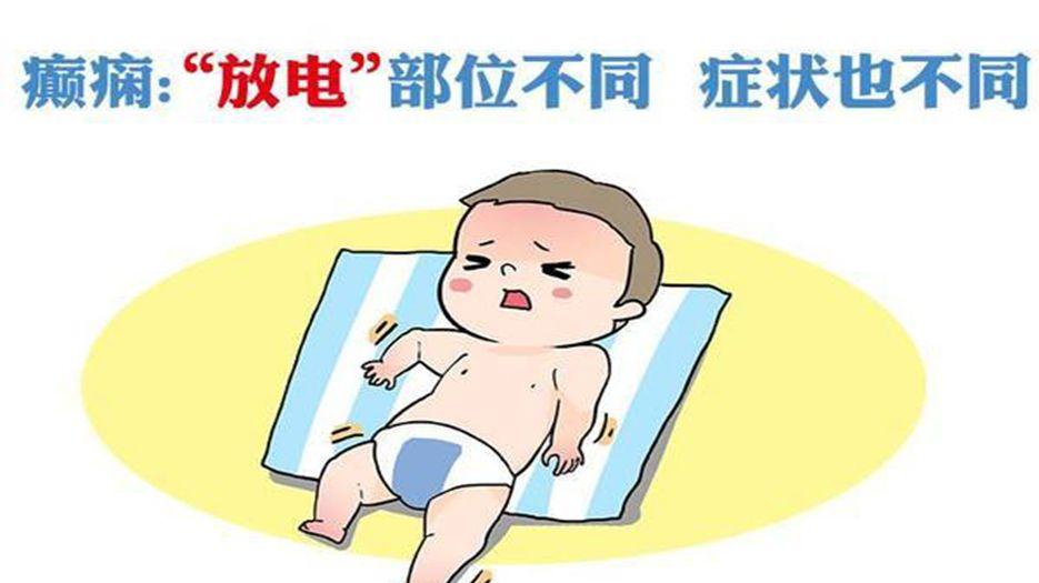 癫痫.jpg