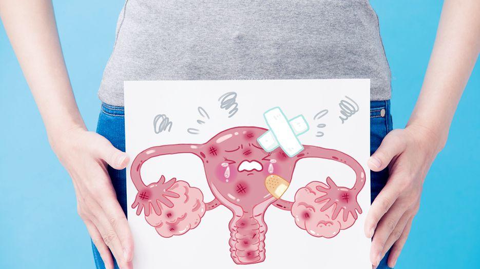 子宫腺肌症试管成功经验分享-附2023子宫腺肌症试管成功案例.jpg