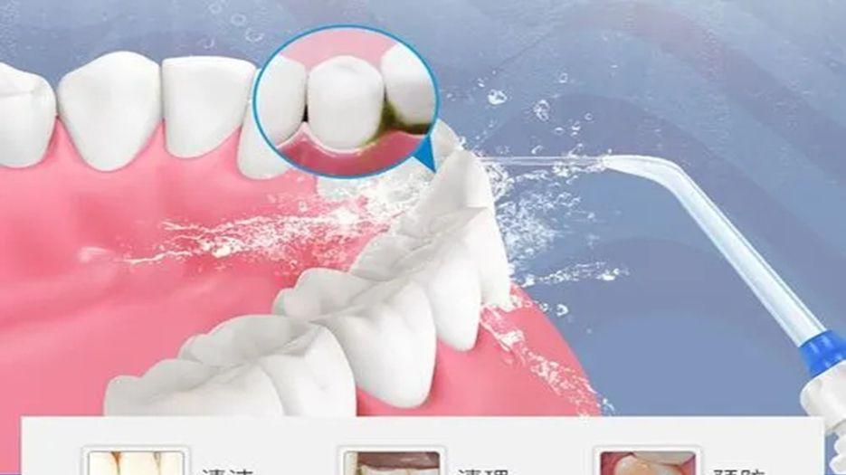 洗牙.webp.jpg