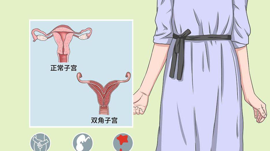 双角子宫.jpg