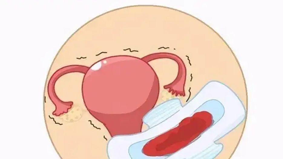 月经期.webp.jpg