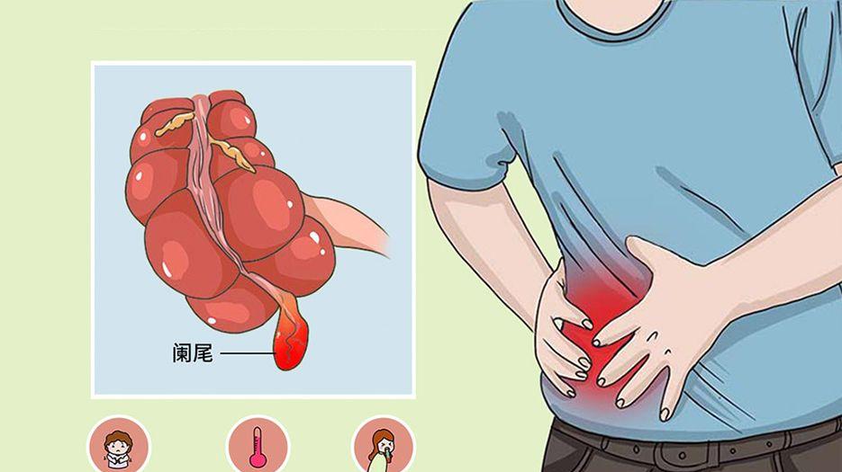 阑尾炎.jpg