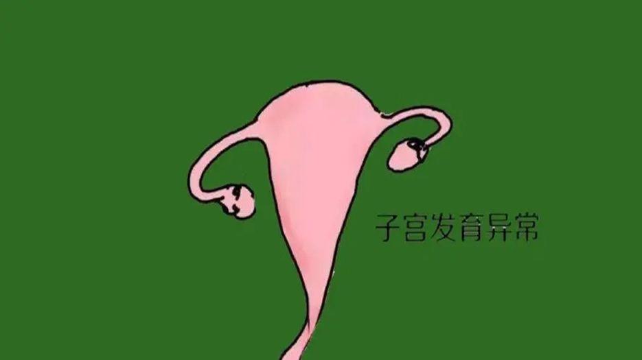 子宫畸形.webp.jpg
