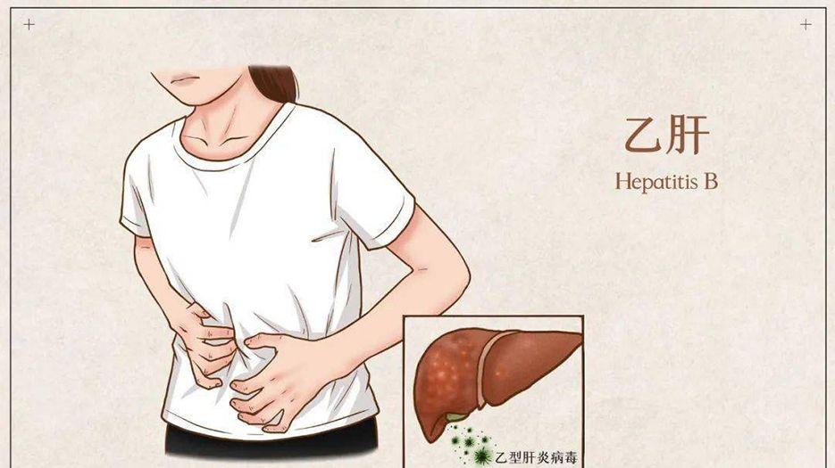 乙型肝炎.jpeg